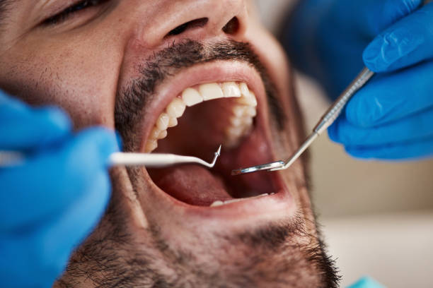 Best Walk-In Emergency Dental Services in Marion, NC