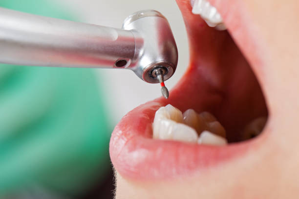 Best Emergency Denture Repair in Marion, NC